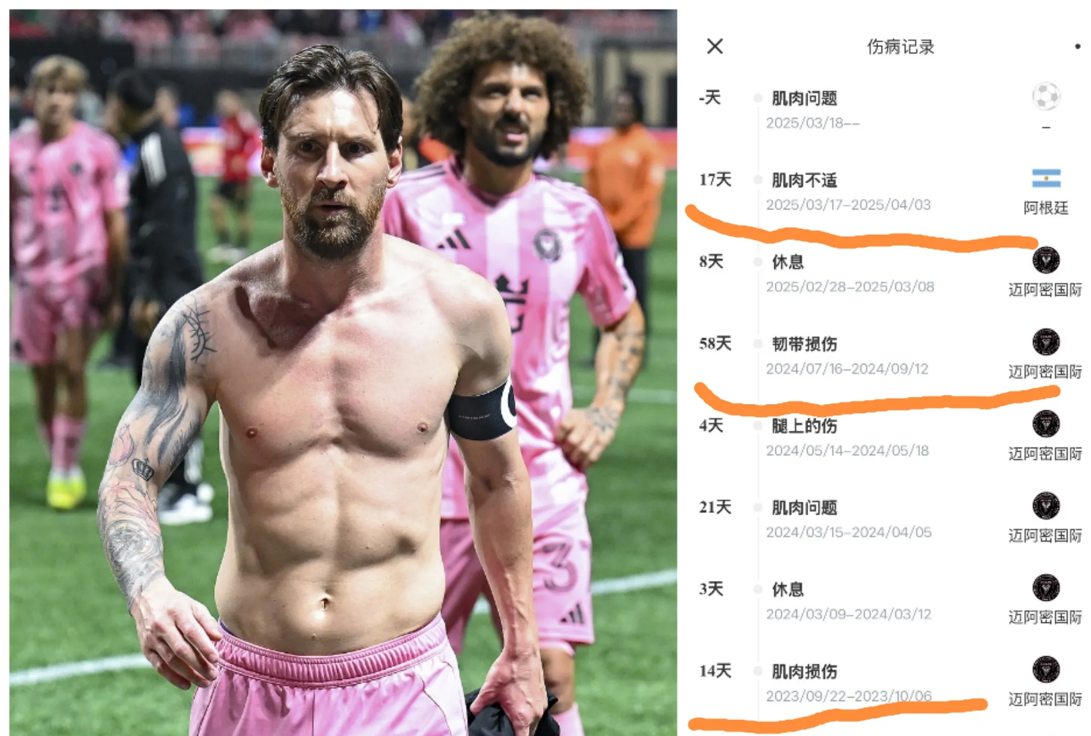 关于梅西带伤出战，可能缺席即将开战的欧洲杯的信息